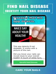 find nail disease ipad resimleri 2