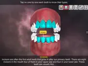 incredible human teeth ipad images 4