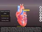 sections of human heart ipad images 4