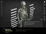 insight prostate ipad images 4
