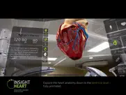 insight heart lite ipad images 4