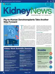 asn kidney news ipad images 3