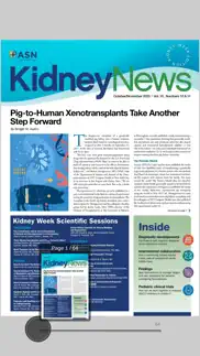 asn kidney news iphone images 4