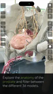insight prostate iphone images 3