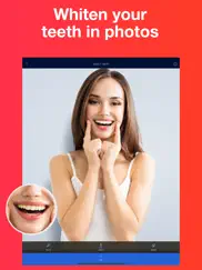 teeth whitener - photo editor ipad images 1