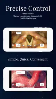 endoscope app iphone bildschirmfoto 3